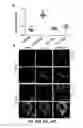 Fig. 48 - Methods and compositions for inhibiting retinopathy of prematurity