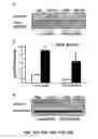 Fig. 56 - Methods and compositions for inhibiting retinopathy of prematurity