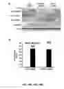 Fig. 58 - Methods and compositions for inhibiting retinopathy of prematurity