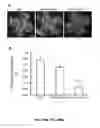 Fig. 68 - Methods and compositions for inhibiting retinopathy of prematurity