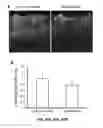 Fig. 72 - Methods and compositions for inhibiting retinopathy of prematurity
