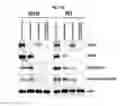 Fig. 32 - Method and composition for diagnosis or treatment of aggressive prostate cancer