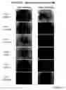 Fig. 35 - NOVEL METHOD FOR LABELLING CANCERIZATION-CAUSING CELL IN STEM CELLS, AND THERAPY METHOD