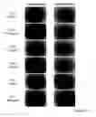 Fig. 43 - NOVEL METHOD FOR LABELLING CANCERIZATION-CAUSING CELL IN STEM CELLS, AND THERAPY METHOD