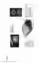 Fig. 05 - SELF-ASSEMBLY OF DNA ORIGAMI: A NEW DIAGNOSTIC TOOL