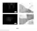 Fig. 07 - LANCE NOZZLE, METHOD FOR MANUFACTURING LANCE NOZZLE AND APPARATUS FOR MANUFACTURING LANCE NOZZLE