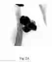 Fig. 03 - Catalyst structure for electrolysis of water and method of forming the same