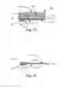 Fig. 17 - Methods and apparati for making thin semi-conductor wafers with locally controlled regions that are relatively thicker than other regions and such wafers