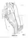 Fig. 02 - Thermally insulative spacer and methods involving use of same