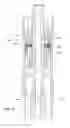 Fig. 37 - SUBSEA CASING DRILLING SYSTEM