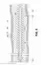 Fig. 06 - Method of completing and producing long lateral wellbores