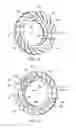 Fig. 09 - INDIVIDUALLY COMPLIANT SEGMENTS FOR SPLIT RING HYDRODYNAMIC FACE SEAL