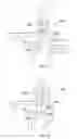 Fig. 06 - Levered joint