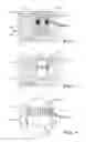 Fig. 05 - Fuel Injector Filter