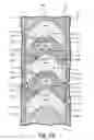 Fig. 09 - PACKING STACKS FOR PISTON PUMPS