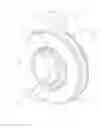 Fig. 09 - Torque limiter, printer and gear-set