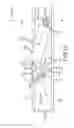 Fig. 11 - Methods and apparatus for a suspension system