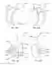Fig. 14 - Compound bows with modified cams