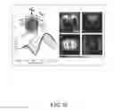 Fig. 13 - Nanoscale optical tomography with cathodoluminescence spectroscopy