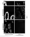 Fig. 04 - Antigen detection using photocleavable labels