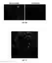 Fig. 14 - Antigen detection using photocleavable labels