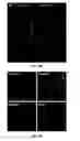 Fig. 22 - Antigen detection using photocleavable labels