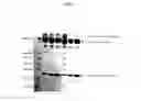 Fig. 12 - Covalently linked thermostable kinase for decontamination process validation