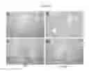 Fig. 03 - Methods for Diagnosing and Treating Iron Dysregulation
