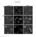 Fig. 04 - Methods for Diagnosing and Treating Iron Dysregulation
