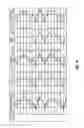 Fig. 12 - Method and apparatus for determining a fracture aperture in a wellbore