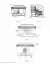 Fig. 05 - Zoom objective lens of operating microscope