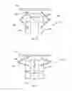 Fig. 03 - Loupe attachment apparatus and system