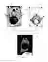 Fig. 04 - Treatment planning and evaluation for rectal cancer via image analytics
