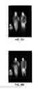 Fig. 12 - Edge guided interpolation and sharpening