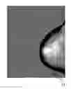 Fig. 01 - Evaluation of an x-ray image of a breast produced during a mammography