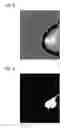 Fig. 04 - Evaluation of an x-ray image of a breast produced during a mammography