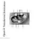 Fig. 05 - Methods and apparatus for 3D imaging and custom manufacturing
