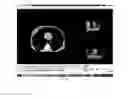 Fig. 11 - Virtual radiation oncology clinic and methods of use thereof