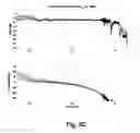 Fig. 09 - Feedback adaptive noise cancellation (ANC) controller and method having a feedback response partially provided by a fixed-response filter