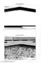Fig. 07 - Etching apparatus