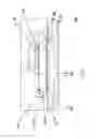 Fig. 03 - Semiconductor die attachment with embedded stud bumps in attachment material