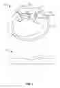 Fig. 02 - 3D shaped inductive charging coil and method of making the same