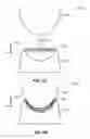 Fig. 07 - 3D shaped inductive charging coil and method of making the same