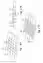 Fig. 20 - Wireless energy transfer for implantable devices