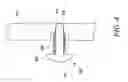 Fig. 05 - System and method for disassembling a drive pinion assembly of starter motor