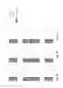 Fig. 11 - Reference signal interference management in heterogeneous network deployments