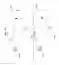 Fig. 400 - Information communication method for obtaining information specified by striped pattern of bright lines