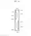 Fig. 10 - Loudspeaker