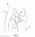 Fig. 03 - NURSING GARMENT