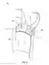 Fig. 04 - NURSING GARMENT
